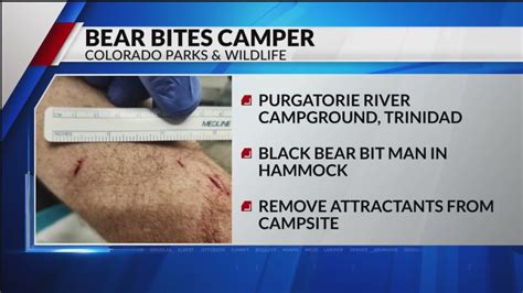 Bear attacks camper relaxing in hammock: CPW